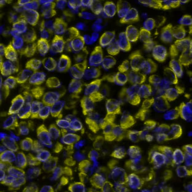 Cytokeratin, pan Antibody (AE-1/AE-3)